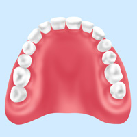 保険適用の入れ歯