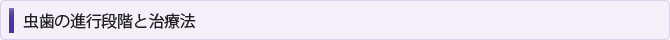 虫歯の進行段階と治療法